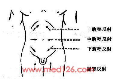 腹壁反射检查方法图示图片