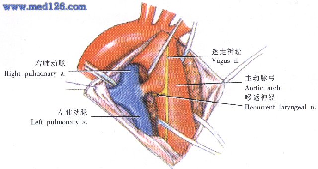 动脉导管未闭解剖图图片